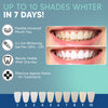 Universal Teeth Whitening Kit