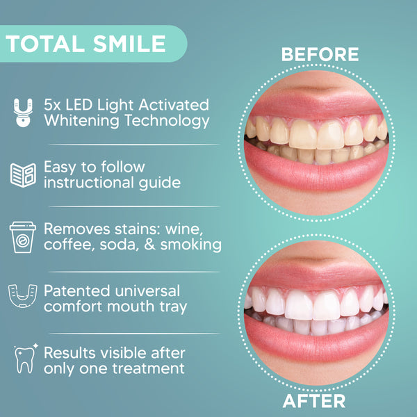 Teeth Whitening Kit with LED Accelerator - Total Smile